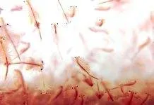 Comment accélérer l’éclosion des nauplies d’artémia accélérer l'éclosion des nauplies d'artémia